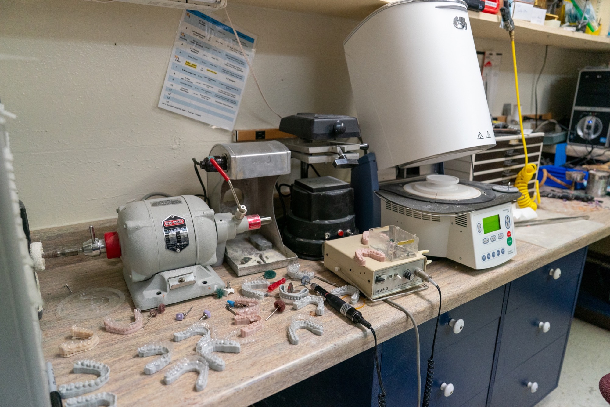 Digital dental lab equipment and printed models at Progressive Dental